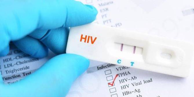 HIV