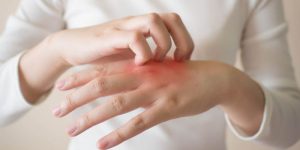 10 Jenis Penyakit Kulit & Cara Mudah Mengatasinya