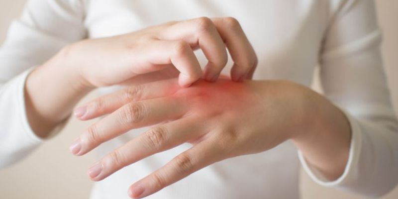 10 Jenis Penyakit Kulit & Cara Mudah Mengatasinya