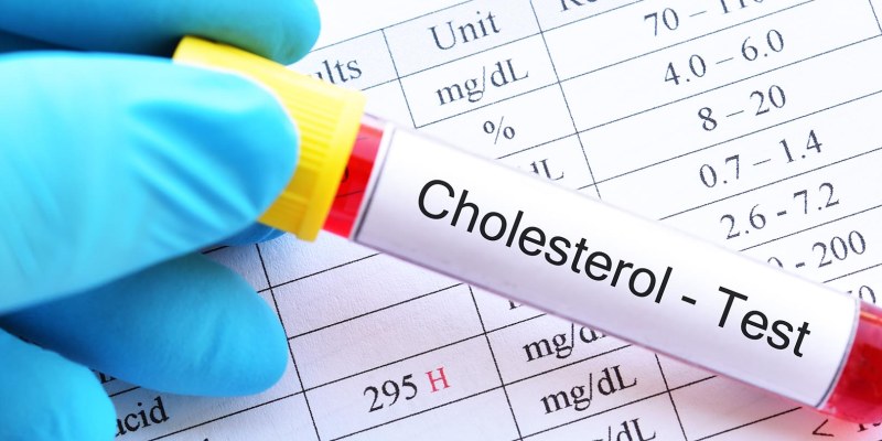 10 Tips Menjaga Kadar Kolesterol Tubuh agar Tetap Normal