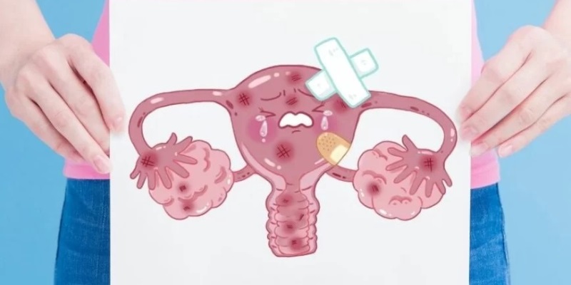 Mengenal Kehamilan Ektopik - Tanda, Penyebab dan Cara Mengobati